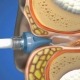 Bideford ear wax removal, Bideford ear syringing, Yelland ear syringing, Northam ear syringing, Merton ear syringing, High Bullen ear syringing,Bradworthy ear syringing, Hartland ear wax removal, Torrington ear syringing, Fremington ear syringing